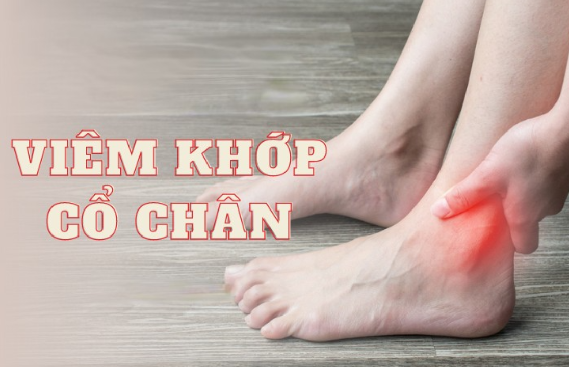 Viêm khớp cổ chân có nguy hiểm không?